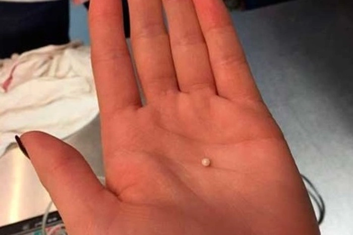 В Челябинске гость ресторана нашел жемчужину в устрице