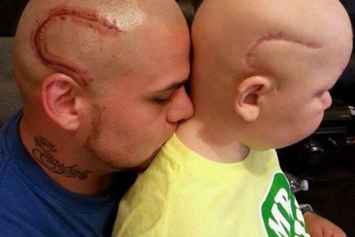 Американец сделал на голове тату в виде шрама, чтобы поддержать больного сына