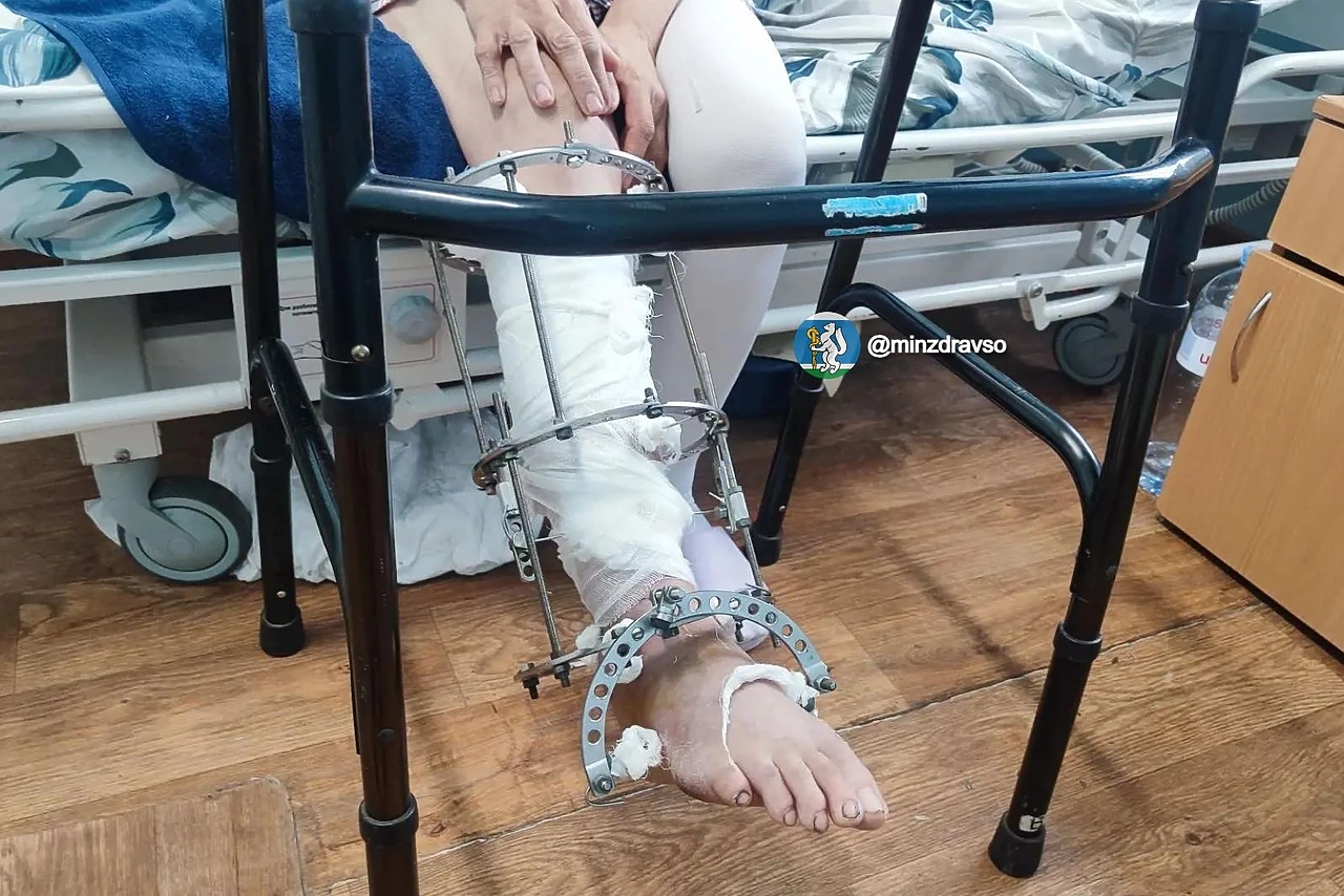 На Урале женщине пришили отрезанную мотоблоком ногу