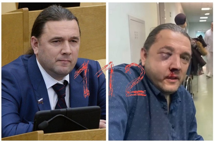 В Москве жестоко избит бывший депутат Госдумы Максим Шингаркин