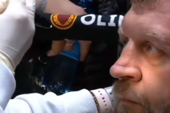 Менеджер Емельяненко объяснил его поведение в Екатеринбурге капельницами