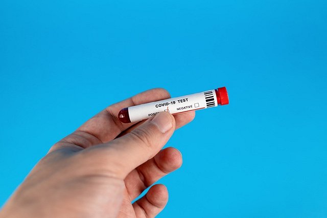 Губернатор объяснил, почему в Свердловской области стали делать меньше тестов на коронавирус