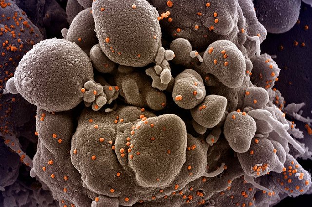 Попова назвала циркулирующие в России штаммы коронавируса