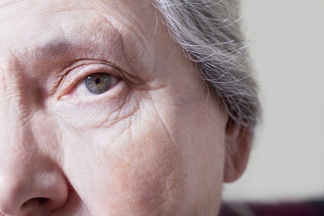 Британка потратила 20 тысяч фунтов детских пособий на пластические операции