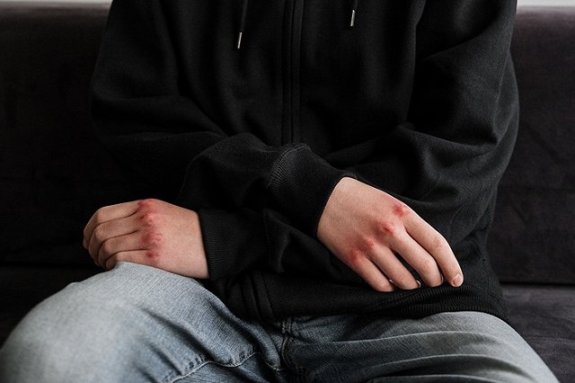 Подростку из Свердловской области, которого избила банда 9 мая, начали угрожать расправой