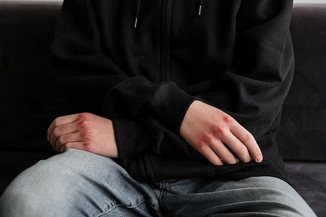 Подростку из Свердловской области, которого избила банда 9 мая, начали угрожать расправой