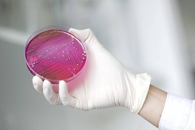 Возбудитель кишечной инфекции у туристов, прилетевшие из Таиланда, установлен