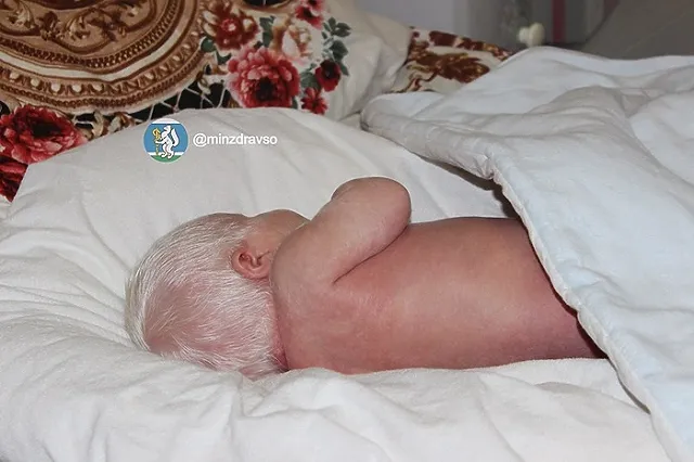 В Свердловской области родился малыш-альбинос с глазами цвета граната