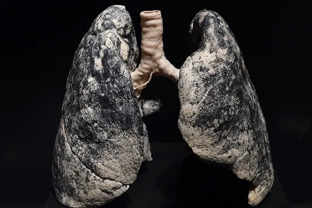 Новые устрашающие картинки на сигаретных пачках появятся весной