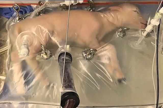 Первый прототип искусственной матки успешно прошёл испытания