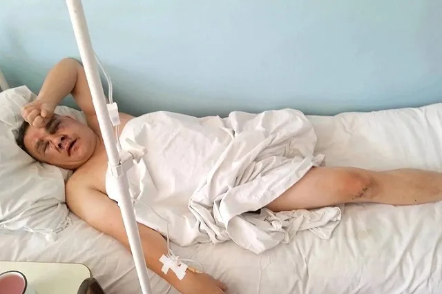 В Забайкалье группа молодежи избила участника СВО без ноги и сорвала c него награды