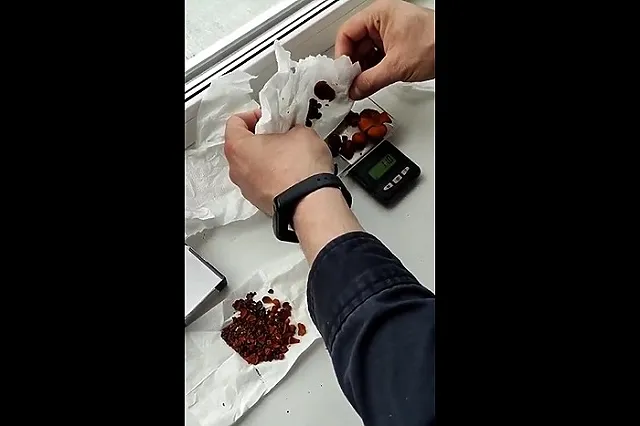 SHOT: В России начали зарабатывать на продаже камней из желчных пузырей