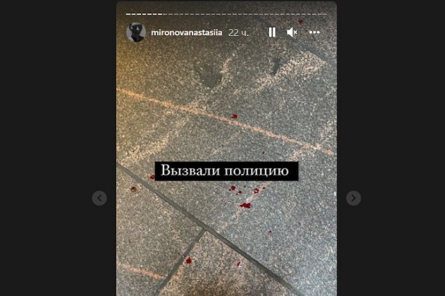 «Вспылил на фоне нервозности». Сотрудник Эрмитажа сломал нос заблудившемуся посетителю