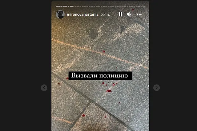 «Вспылил на фоне нервозности». Сотрудник Эрмитажа сломал нос заблудившемуся посетителю