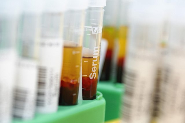 Для жителей поселка Шарташ анализы крови сделали платными