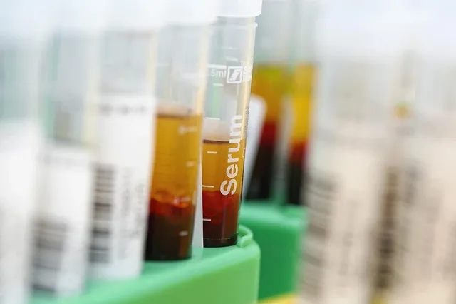 Для жителей поселка Шарташ анализы крови сделали платными