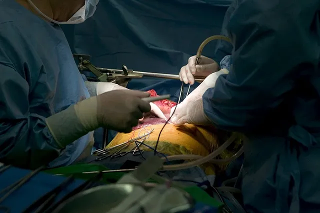 На Среднем Урале впервые провели родственную пересадку печени