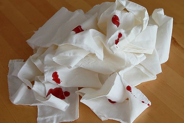 Незнакомец напал с ножом на мужчину в Академическом районе (ФОТО)