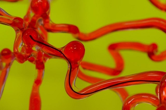 Новый «робочервь» будет путешествовать по сосудам мозга и разрушать тромбы