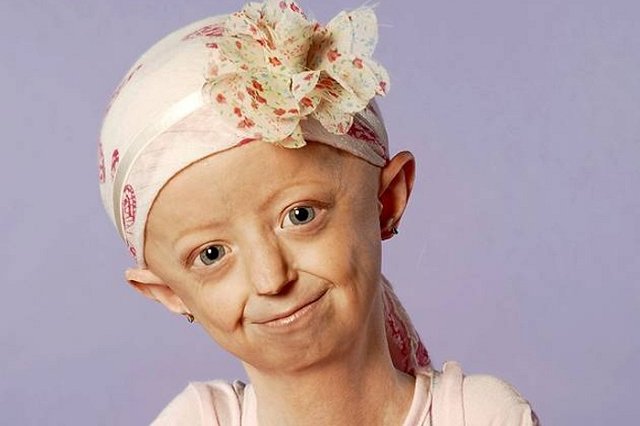 «Столетняя» девушка умерла в 17 лет