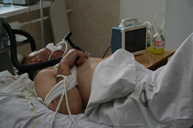 Уральцы стали меньше травиться лекарствами, но больше — бытовой химией