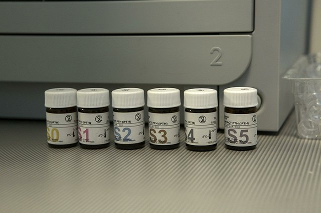 Каждый пятый житель Екатеринбурга умирает от онкологии