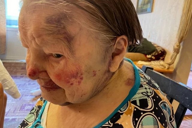 Сиделку-мигрантку, избившую 95-летнюю подопечную, будут судить в Екатеринбурге