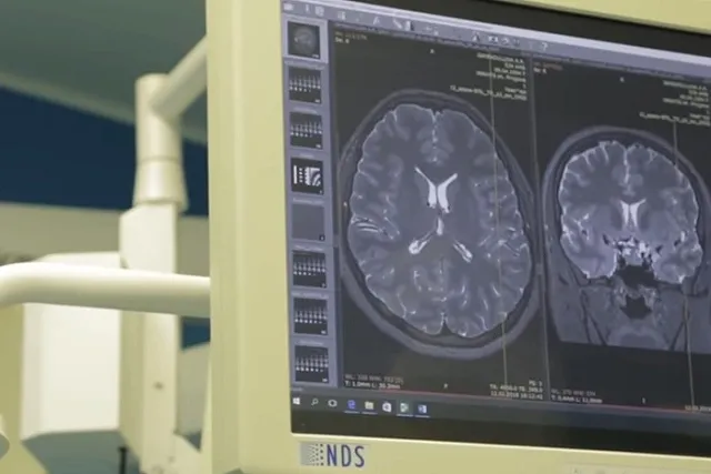 Министр Карлов поставил важную задачу свердловским главврачам