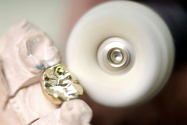 Клиника выплатит челябинке миллион за неправильно вставленные зубы