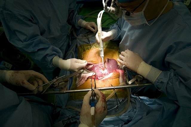 В водительские права россиян хотят добавить пункт о посмертном донорстве