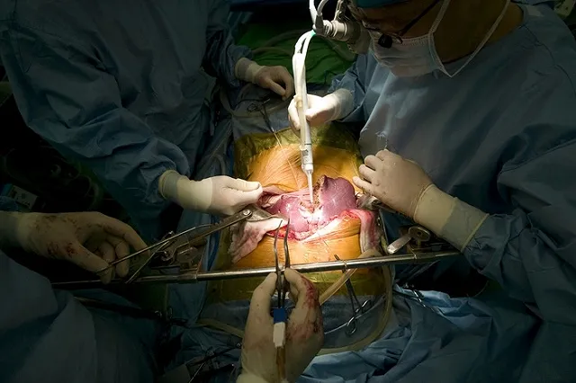 В водительские права россиян хотят добавить пункт о посмертном донорстве