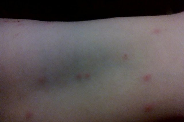 Эксперты рассказали, чем можно заразиться после купания в свердловских водоёмах