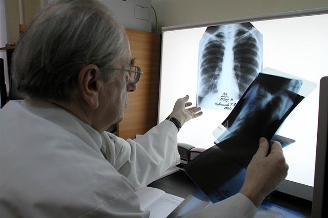 В Екатеринбурге выявлен второй случай заражения туберкулезом у школьника