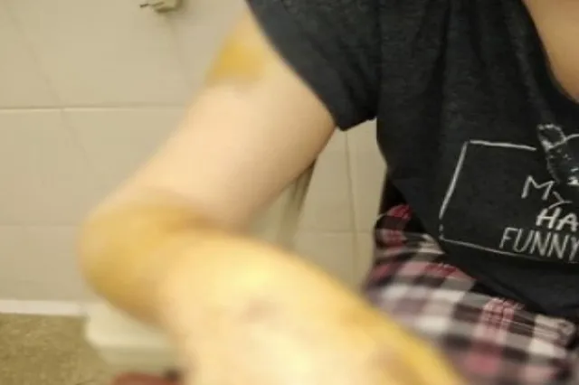 Брошенный муж пытался отрубить топором руки бывшей жене