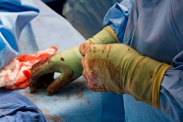 Врачи забыли в животе роженицы салфетку