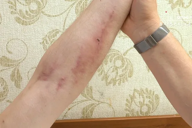 В квартире погибшей пары, где спасли двух маленьких детей, нашли метадон