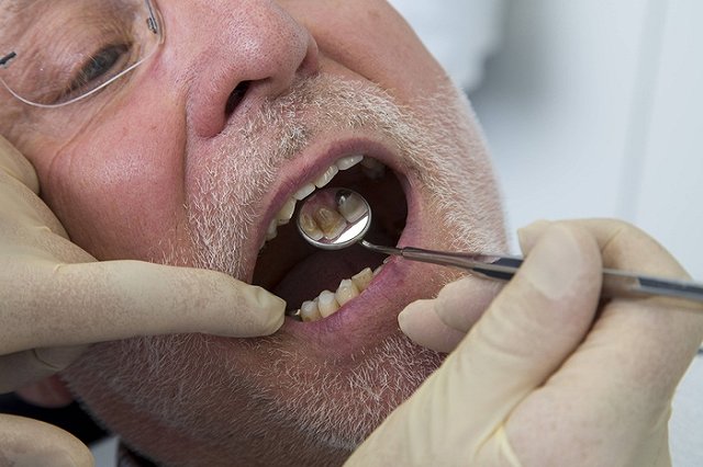 В ХМАО журналист судится со своей телекомпанией за потерянный зуб