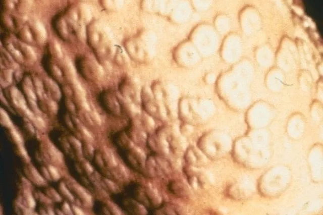 Взрыв сотряс российскую лабораторию, хранящую образцы оспы