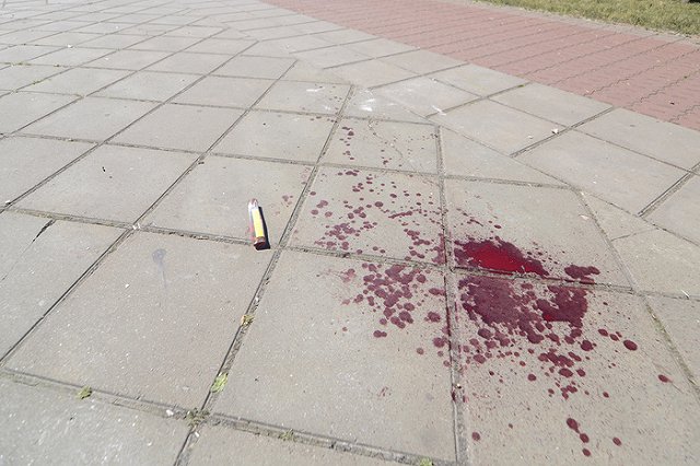 Жестоко избит юрист, готовивший иск о снятии с выборов Ильи Гаффнера