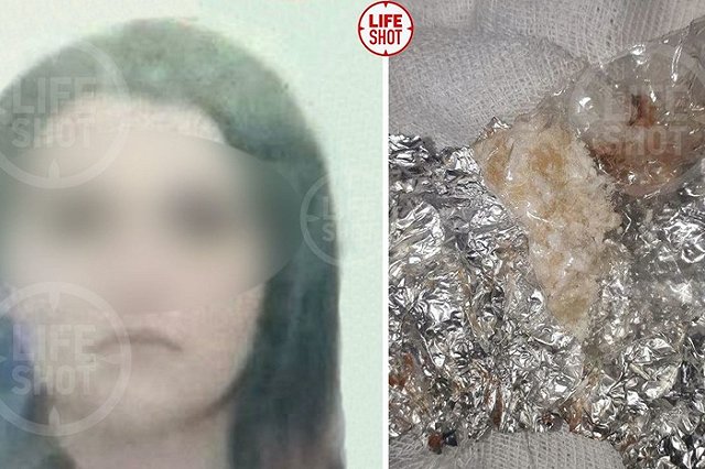 Уралочка проглотила свёрток с наркотиком, но не смогла его самостоятельно достать