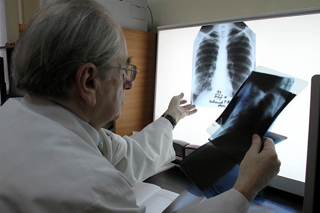 Поликлиники Екатеринбурга в субботу приглашают горожан на флюорографию