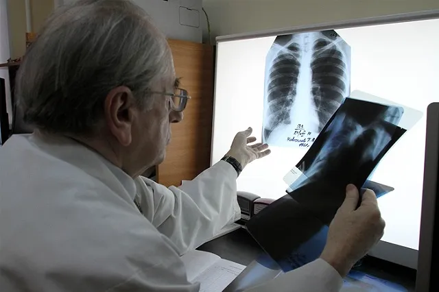 Поликлиники Екатеринбурга в субботу приглашают горожан на флюорографию