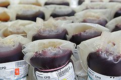 В Петербурге ребенку перелили ВИЧ-инфицированную кровь