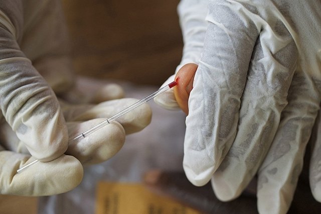 Свердловская область вошла в тройку регионов с самой высокой смертностью от ВИЧ