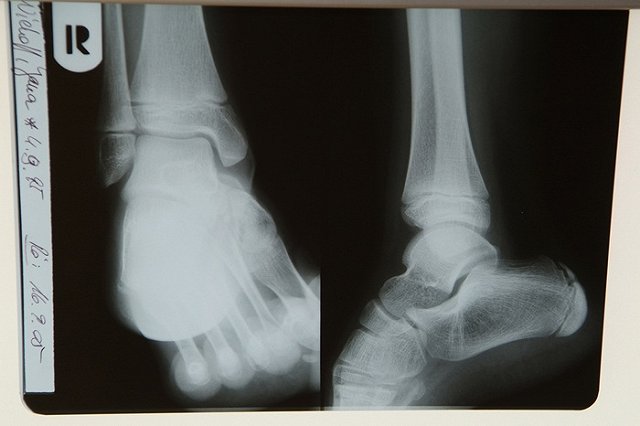 В Волгограде детский врач сядет на десять лет за торговлю спайсами