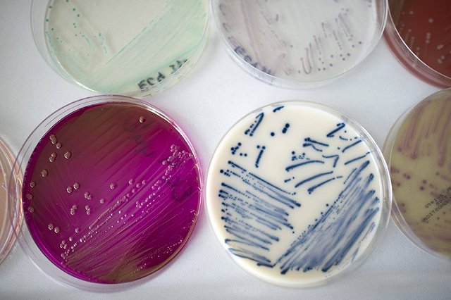 В Свердловской области зафиксировали вспышку ротовирусной инфекции