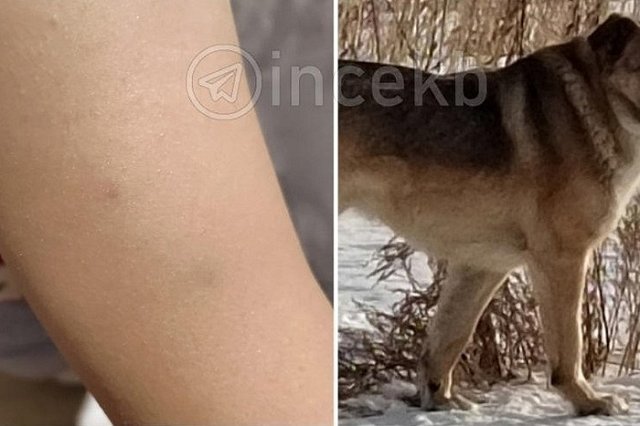 «Напала на троих детей»: в свердловском посёлке собака с передержки кидается на людей