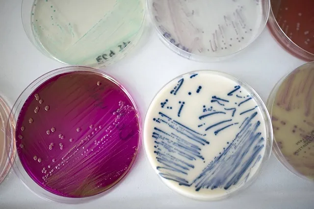 В Москве выявлен третий случай заражения Зикой