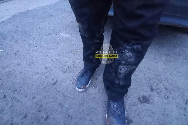 В Нижнем Тагиле собака напала на 13-летнего подростка