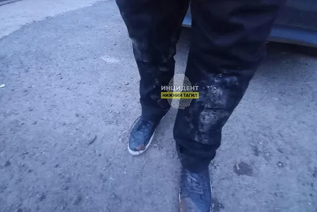 В Нижнем Тагиле собака напала на 13-летнего подростка